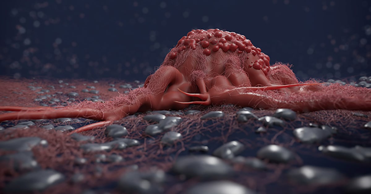 3d rendered image, enhanced scanning electron micrograph (SEM) of cancer cell
