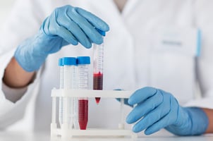 glove hands holding blood samples