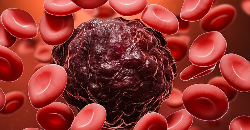 3D rendering of cancer cell surrounded by red blood cells