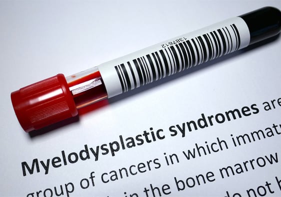 Myelodysplastic syndrome - blood disorder abstract.