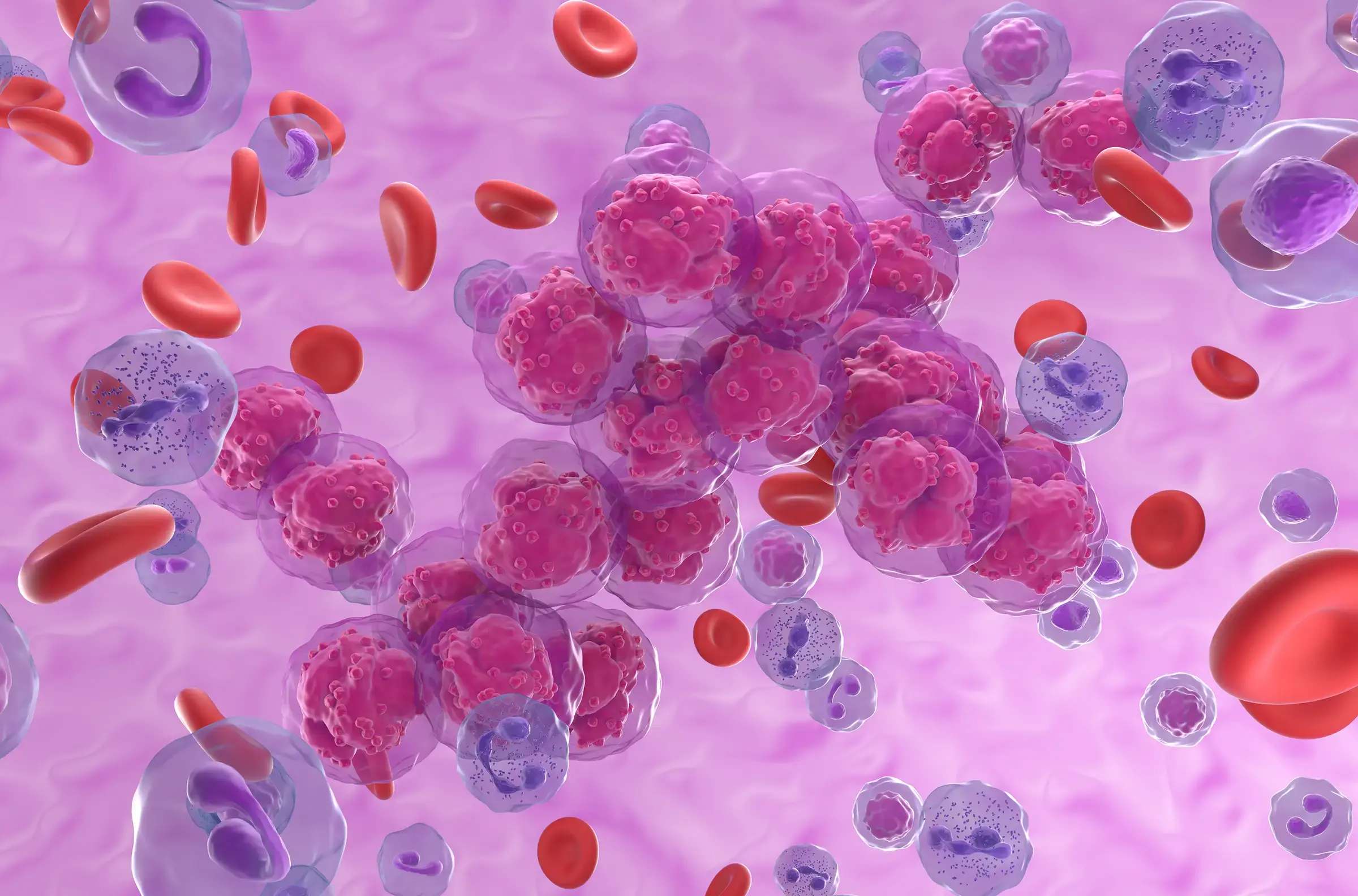 Blood cancer cells in the blood stream.