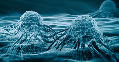 3D rendering of cancer cells