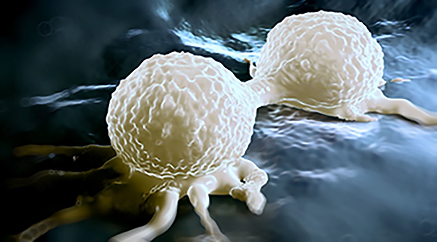 Triple-Negative Breast Cancer (TNBC) cells interacting in the tumor microenvironment.